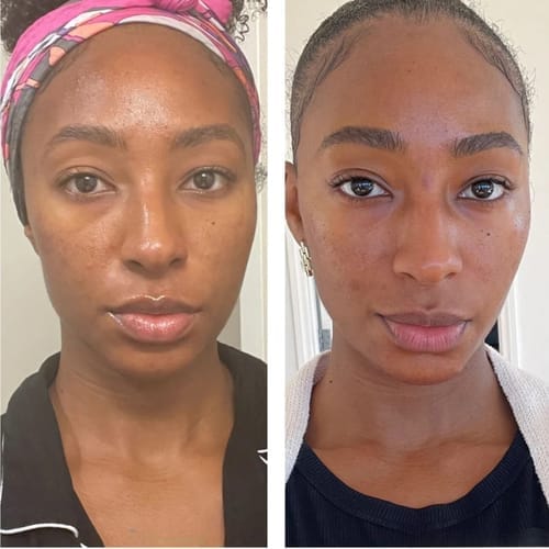 Real customer result 4