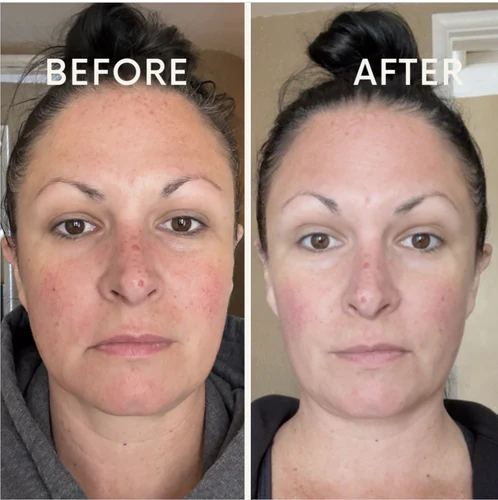 Real customer result 6